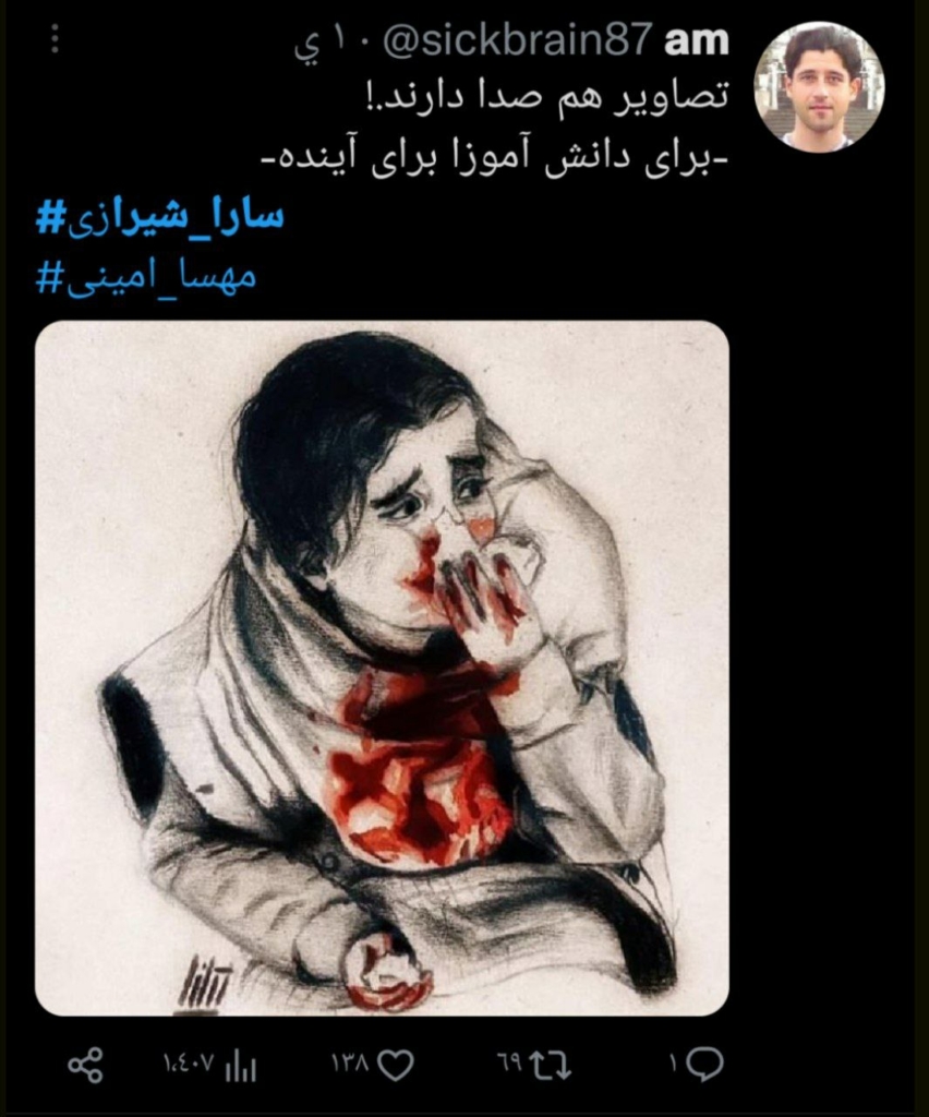 صورة فتاة ملطّخة بالدماء تثير الغضب والسلطات تنفي علاقة القضية بالحجاب 3